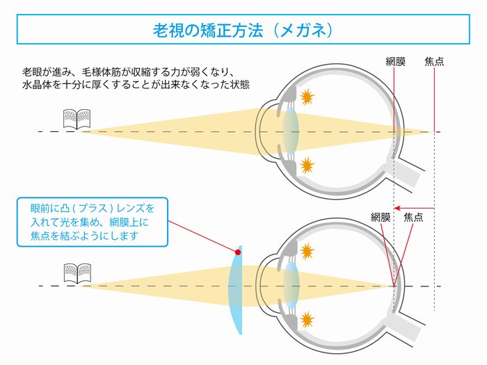 近視・遠視・乱視・老視とは? | 遠近両用メガネ・老眼情報サイト|えんきんドットコム