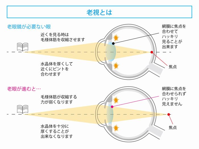 近視 遠視 乱視 老視とは 遠近両用メガネ 老眼情報サイト えんきんドットコム